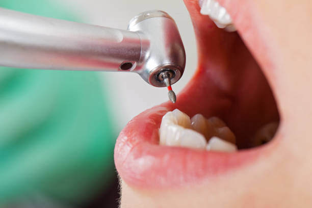 Best Chipped Tooth Repair Near Me  in Campbellsville, KY